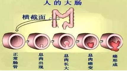 微信图片_20170518133708.png